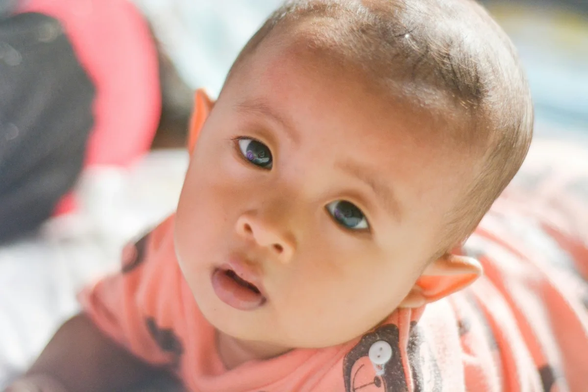 Croûtes de lait bébé : causes et soins