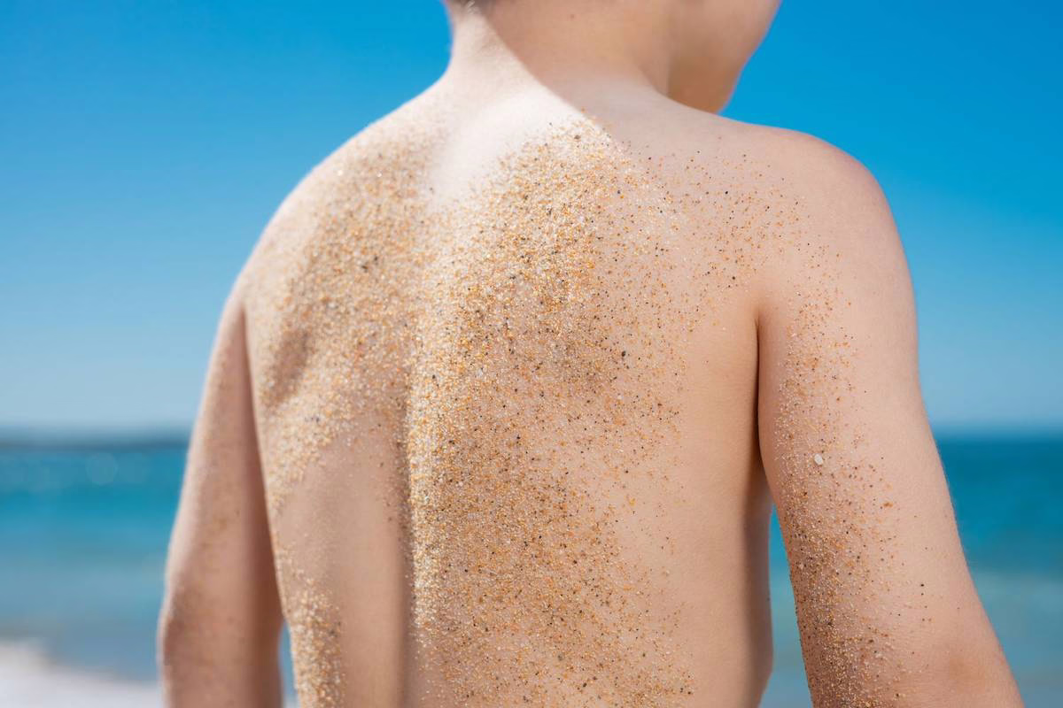 Coup de soleil chez l&rsquo;enfant : les bons gestes pour le soulager vite