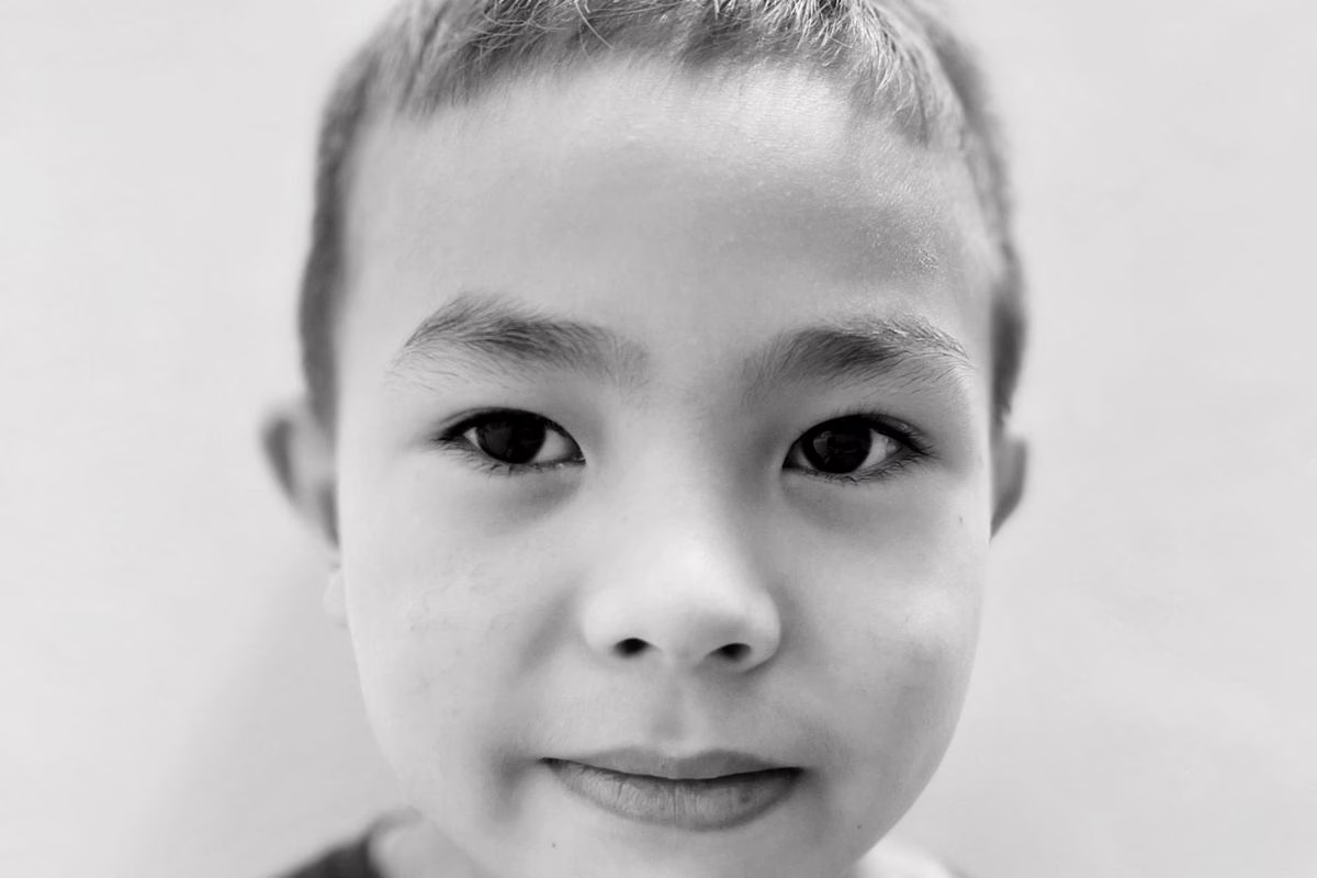 Orgelet chez l&rsquo;enfant : ce petit bouton sur la paupière à ne pas percer